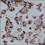 Fibrinogen alpha chain Antibody in Immunohistochemistry (Paraffin) (IHC (P))