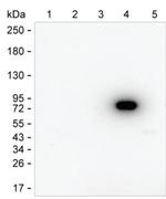 Human IgM Antibody in Western Blot (WB)