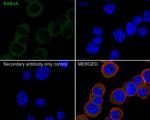 RAB3A Antibody in Immunocytochemistry (ICC/IF)