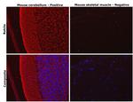 RAB3A Antibody in Immunohistochemistry (Paraffin) (IHC (P))