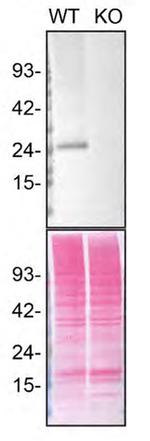 RAB3A Antibody in Western Blot (WB)