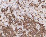 HCLS1 Antibody in Immunohistochemistry (Paraffin) (IHC (P))