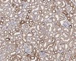 KEAP1 Antibody in Immunohistochemistry (Paraffin) (IHC (P))