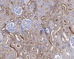 KEAP1 Antibody in Immunohistochemistry (Paraffin) (IHC (P))