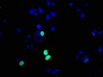 Phospho-Histone H1.4 (Thr17) Antibody in Immunocytochemistry (ICC/IF)