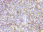 Phospho-Histone H1.4 (Thr17) Antibody in Immunohistochemistry (Paraffin) (IHC (P))