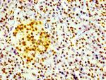 Phospho-Histone H1.4 (Thr17) Antibody in Immunohistochemistry (Paraffin) (IHC (P))