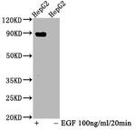 Phospho-STAT5 alpha (Tyr694) Antibody in Western Blot (WB)