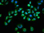 Phospho-AKT1 (Ser473) Antibody in Immunocytochemistry (ICC/IF)