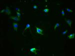 Phospho-Tau (Ser324) Antibody in Immunocytochemistry (ICC/IF)