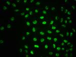 Phospho-ATM (Ser1981) Antibody in Immunocytochemistry (ICC/IF)