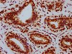 Phospho-Rb (Ser780) Antibody in Immunohistochemistry (Paraffin) (IHC (P))