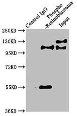 Phospho-Rb (Ser780) Antibody in Immunoprecipitation (IP)