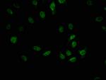 Cdc5L Antibody in Immunocytochemistry (ICC/IF)