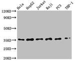 IkB alpha Antibody in Western Blot (WB)