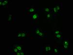 FOXO3A Antibody in Immunocytochemistry (ICC/IF)