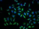 LDLR Antibody in Immunocytochemistry (ICC/IF)