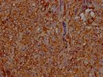 LDLR Antibody in Immunohistochemistry (Paraffin) (IHC (P))