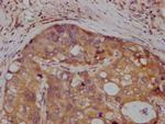 c-Met Antibody in Immunohistochemistry (Paraffin) (IHC (P))