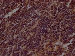 TERT Antibody in Immunohistochemistry (Paraffin) (IHC (P))