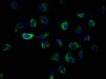 ILK Antibody in Immunocytochemistry (ICC/IF)