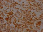 SERPINH1 Antibody in Immunohistochemistry (Paraffin) (IHC (P))