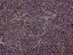 EZH2 Antibody in Immunohistochemistry (Paraffin) (IHC (P))