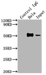 FOXA1 Antibody in Immunoprecipitation (IP)