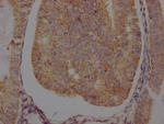 beta-2 Adrenergic Receptor Antibody in Immunohistochemistry (Paraffin) (IHC (P))