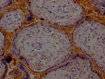 Haptoglobin Antibody in Immunohistochemistry (Paraffin) (IHC (P))