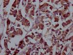 FGFR4 Antibody in Immunohistochemistry (Paraffin) (IHC (P))