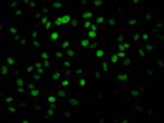 PARP1 Antibody in Immunocytochemistry (ICC/IF)