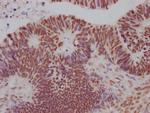 SIN3A Antibody in Immunohistochemistry (Paraffin) (IHC (P))