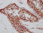 SIN3A Antibody in Immunohistochemistry (Paraffin) (IHC (P))