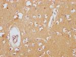 Apolipoprotein J Antibody in Immunohistochemistry (Paraffin) (IHC (P))