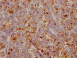 Apolipoprotein J Antibody in Immunohistochemistry (Paraffin) (IHC (P))