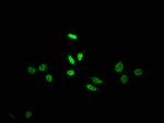 SKP2 Antibody in Immunocytochemistry (ICC/IF)