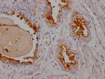 PSMA Antibody in Immunohistochemistry (Paraffin) (IHC (P))