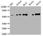 PAK2 Antibody in Western Blot (WB)