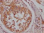 B-Raf Antibody in Immunohistochemistry (Paraffin) (IHC (P))