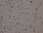 ADAR1 Antibody in Immunohistochemistry (Paraffin) (IHC (P))