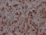 NUP153 Antibody in Immunohistochemistry (Paraffin) (IHC (P))