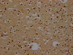 CRM1 Antibody in Immunohistochemistry (Paraffin) (IHC (P))