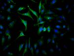 JAK2 Antibody in Immunocytochemistry (ICC/IF)