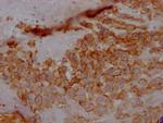 5T4 Antibody in Immunohistochemistry (Paraffin) (IHC (P))