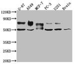 5T4 Antibody in Western Blot (WB)