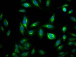 RHEB Antibody in Immunocytochemistry (ICC/IF)