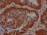 ILF3 Antibody in Immunohistochemistry (Paraffin) (IHC (P))