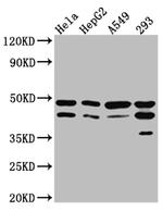 GSK3B Antibody in Western Blot (WB)