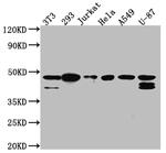 CK2 alpha-1 Antibody in Western Blot (WB)